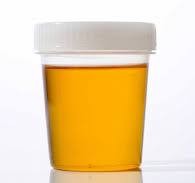 JPG Image, 4KB, 195px × 183px