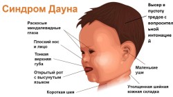 JPG Image, 119KB, 1282px × 720px
